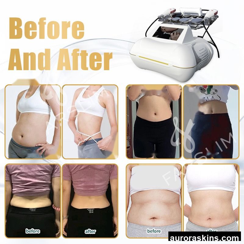 448k R1F Tecar Therapy Cet Ret Machine 448KHz Indiba Tecar Therapy Physical Therapy Pain Relief Skin Tightening Cet Ret Machine