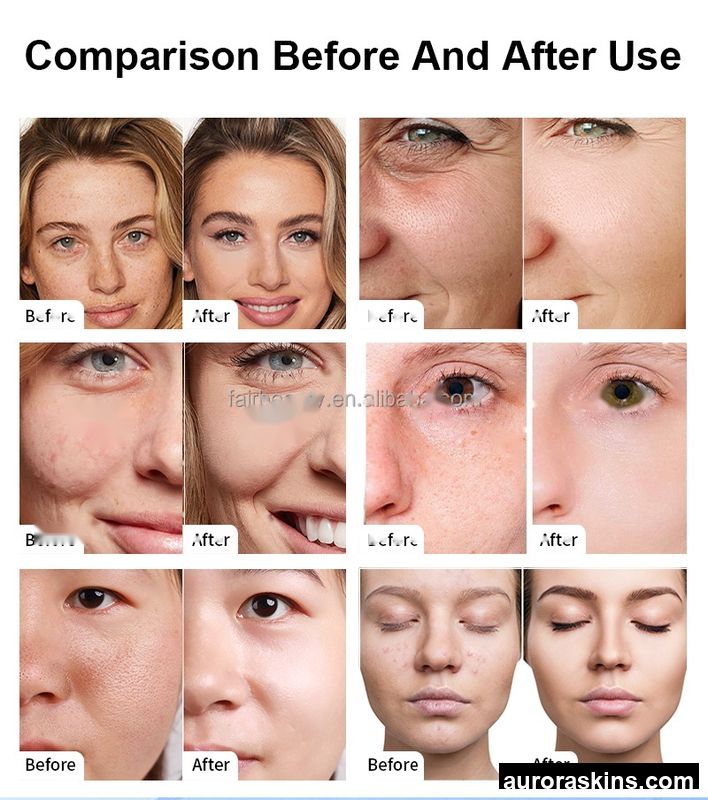 Advanced 360-Degree Spiral Suction Skin Purifier with Oxygen Bubble Technology-Revitalizing Beauty Equipment