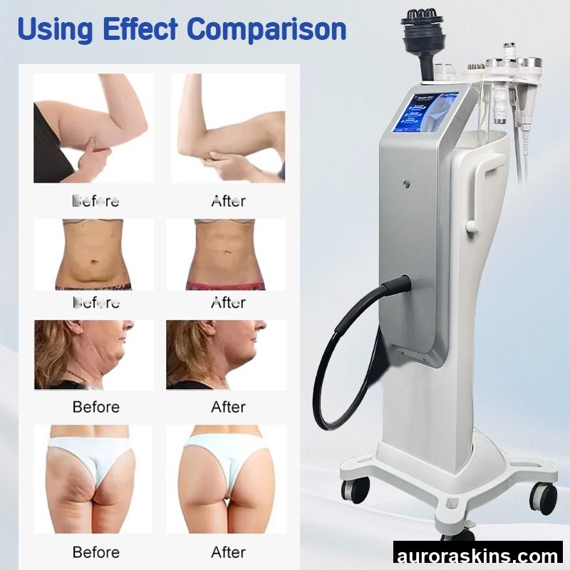 OEM ODM 80K Strong Cavi G5 Vibration 40K 80K Cavi Lymphatic Drainage Vacuum Therapy 40k Cavi Body Slimming Machine