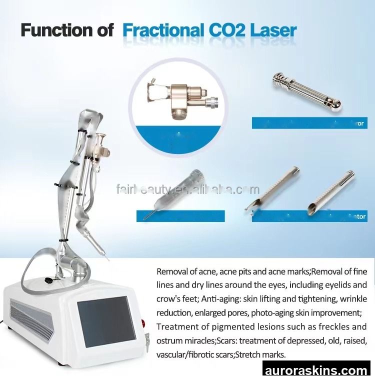 2026 Aurora Skins High-Power 60W CO2 Fractional Device-Rejuvenates Skin, Tightens Face (or Firms), and Removes Acne Scars