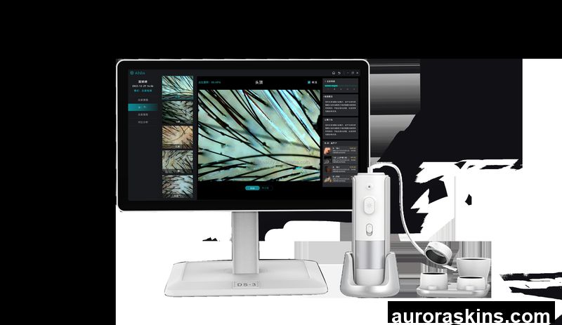 Trichoscopy Scalp Hair Analyzer Desktop Camera with WiFi AI Intelligence Detection 2026 New Design & Technology