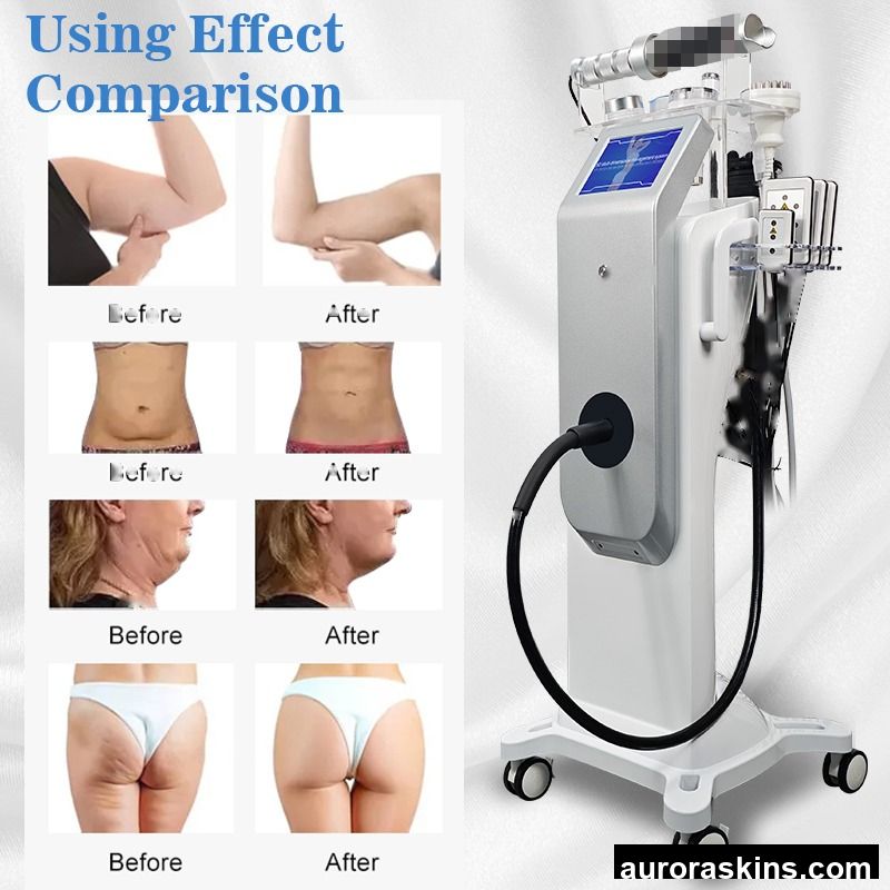 80K Vibration Massage Vacuun Therapy 9 in 1 Cavi Lymphatic Drainage Inner Ball Roller 40k Cavi Machine 80K Cavi Machine