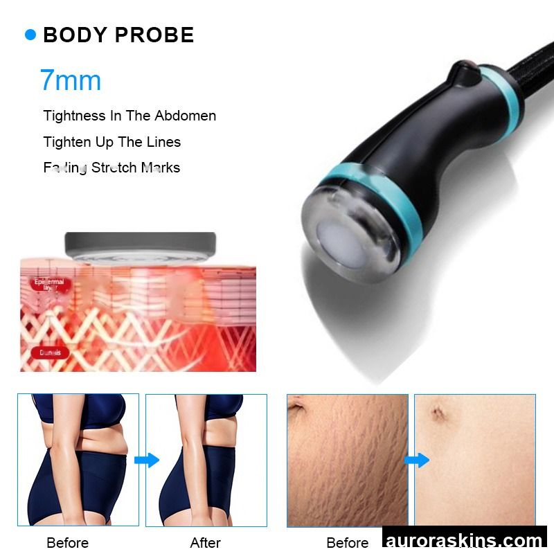 Ice-Microwave Fat Dissolving Body Shaping Machine Cellulite Removal Anti-Aging Coolwave 2.45GHz Microwave Beauty Machine