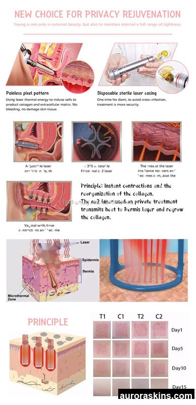 2026 Aurora Skins Multifunctional Anti-Aging Fractional CO2 System-Skin Renewal, Scar & Pigment Reduction, and Stretch Mark Treatment