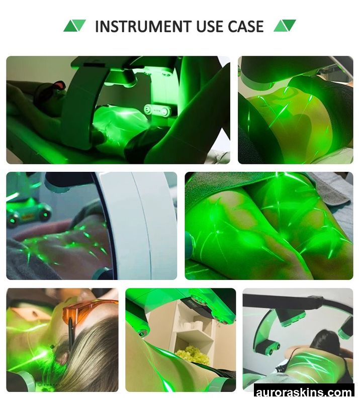 Newest 2026 Fat Removal 10D 532nm 635nm Slimming Machine Vacuum Roller Slimming Massage 10D Green Light Slimming Machine