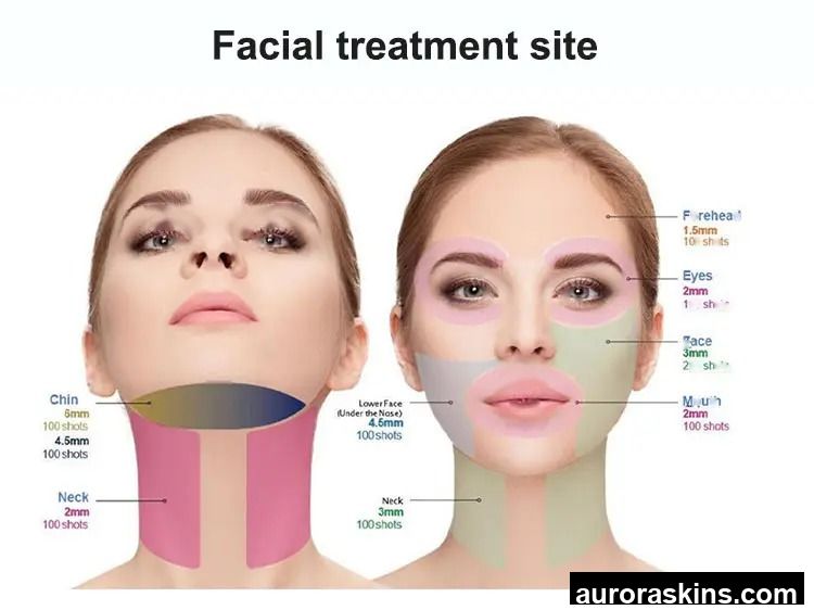 Aurora Skins a 2in1 7D 12D Face Body Lifting Massager Tightening Remove Wrinkle Jade Roller 7 Cartridges