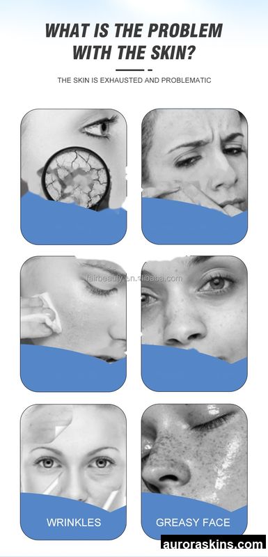 Air Bubble Dermabrasion Deep Cleansing & Firming Skin Rejuvenation Instrument for Body Massage-Salon Spa Use