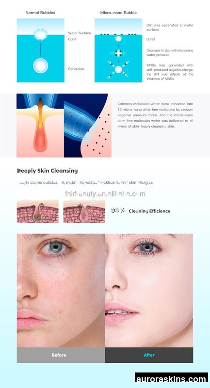 2026 Aurora Skins Compact Bubble Beauty Tool for Face Cleaning-US Plug, Blackhead Removal & Skin Firming-Home Care