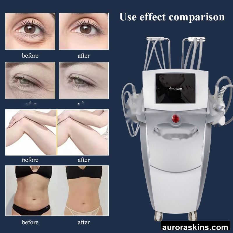 Negative Pressure Inner Roller 3D S Shape Breast Massage Body Sculpting Machine Lymphatic Drainage 360 Rotating Rolling Machine