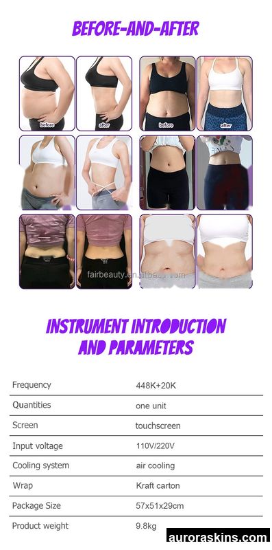 2026 Aurora Skins Factory Direct Sales 448kHz Dual-Function INDIBA Therapy Unit-Relieves Pain, Rejuvenates Skin, Shapes Body