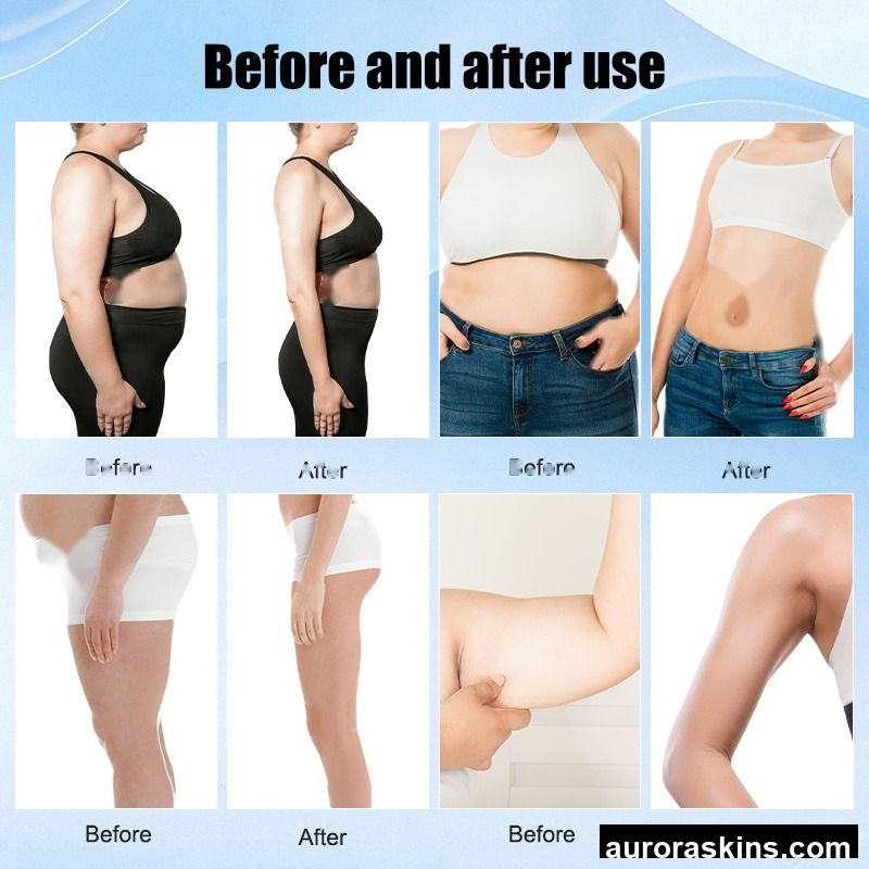 Aurora Skins Choice US LA Stock Free Shipping 80k Cavita 6in1 Vacuum Lipo Lose Weight Body Shaper Machine