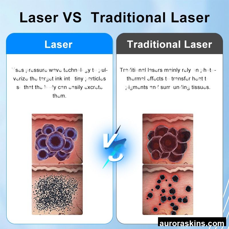 Factory Nd Yag Laser Device Skin Rejuvenation Carbon Facial Peeling Laser Beauty Equipment Carbon Peel Tattoo Removal Machine
