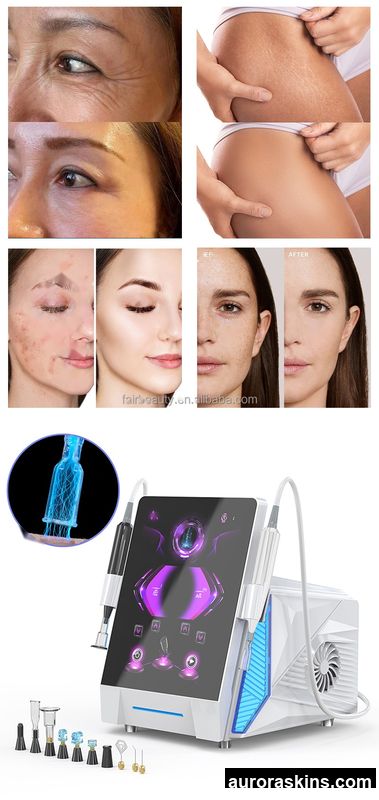 2025 Korea Ozone Plasma Cold Plasma Jet Cosmetology Surgical Machine Scalp Disinfection and Care Device Cold Plasma Machine