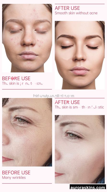 GL6 Certified Facial Machine-Diamond Tip & Oxygen Jet, Water-Infusion Facial for Skin Brightening and Face Lifting