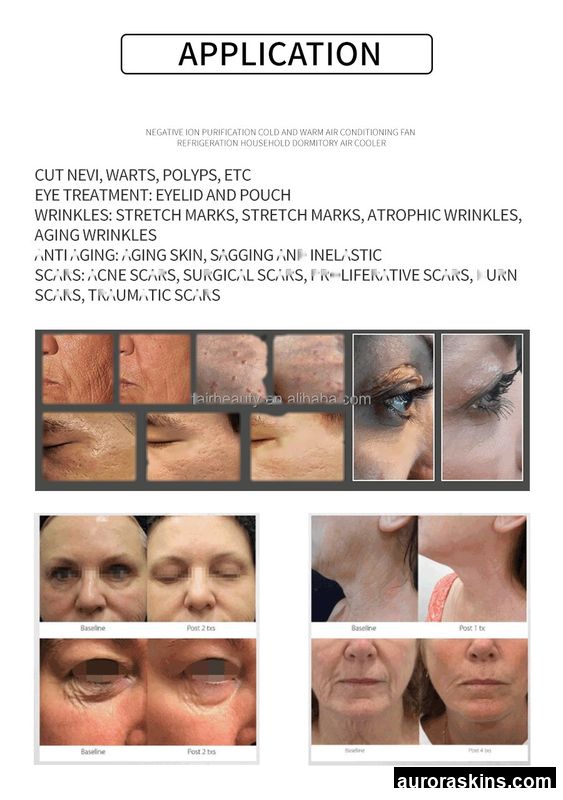 Professional Cold Plasma System-Triple Function: Spot Elimination, Skin Firming, Fibroblast Therapy-Handheld Pen Design