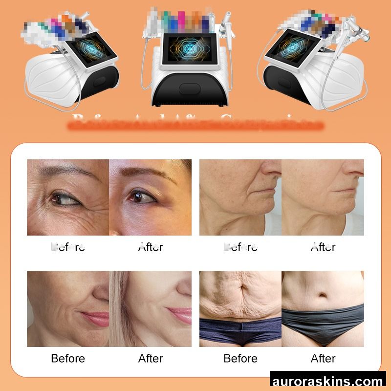 Wrinkle Removal Body Slimming HIIFU Face Rejuvenation High Intensity Focused Anti Wrinkle Machine SMAS Vmax Hiifu Machine