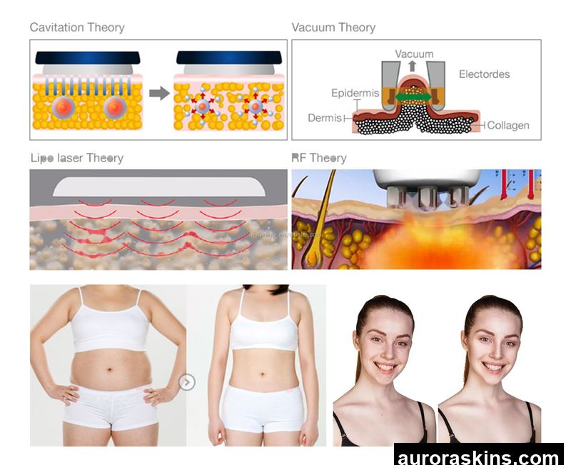 2026 Vacuum 40k/80k Body Shaping & Face Lifting System-Lymphatic Drainage+Thermal Therapy