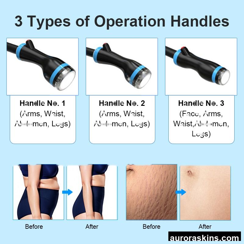 2026 3 in 1 Fat Removal Machine, Salon with 2.45GHz Onda Heat Wave Anti-Aging Ice Microwave Skin Firming and Slimming Machine