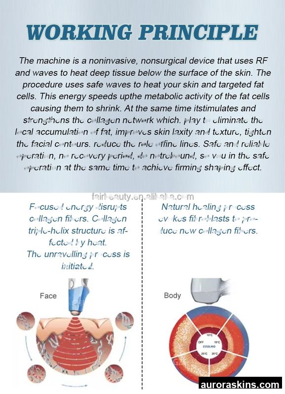 2026 Aurora Skins Direct Sale 360° Dual-Action Non-Invasive Monopolar Thermal Applicator for Skin Tightening and Body Remodeling