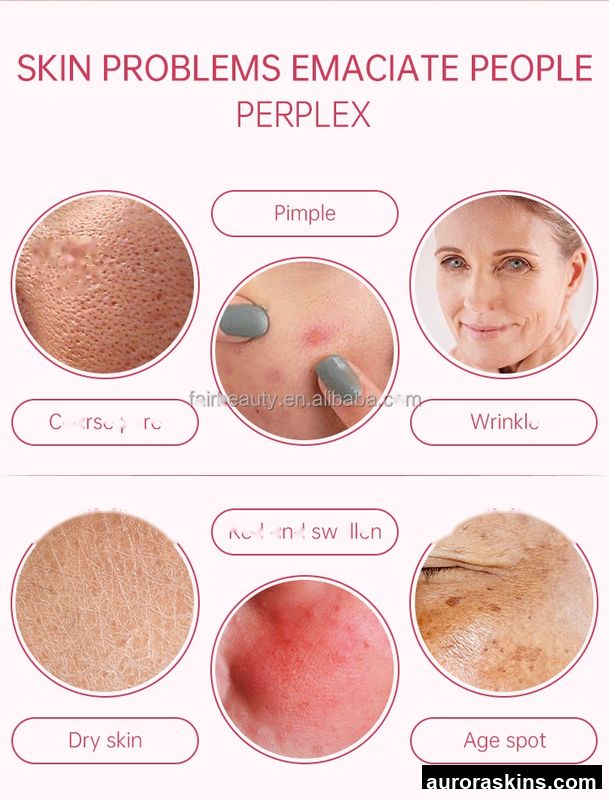 GL6 Certified Facial Machine-Diamond Tip & Oxygen Jet, Water-Infusion Facial for Skin Brightening and Face Lifting