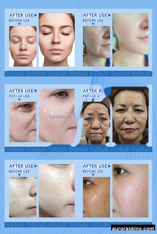 7-in-1 Facial Resurfacing Unit-Hydrating Bubble Vacuum, Skin Brightening, Lifting, Rejuvenation & Deep Cleansing-Quick Shipping