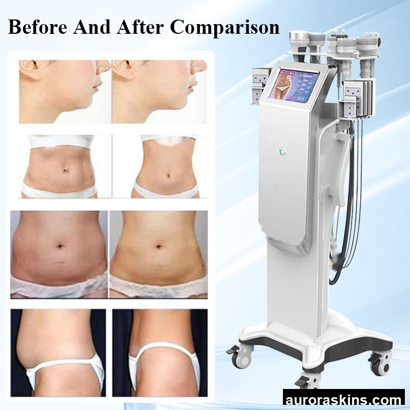 OEM ODM Customized Vacuum Therapy Lymphatic Drainage Breast Massage Fat Removal 80k Cavi 80khz Cavi Body Slimming Machine