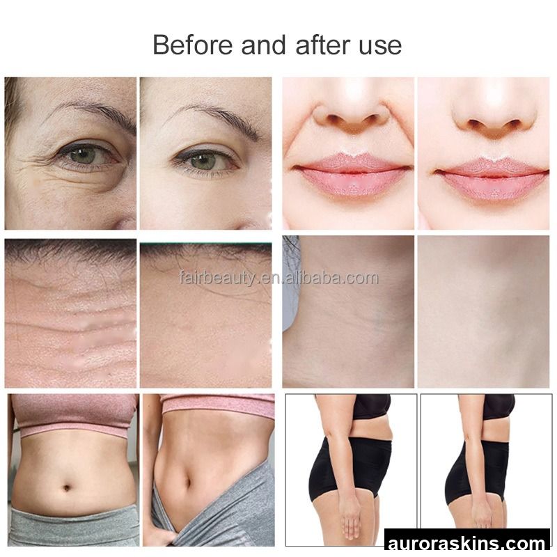 7-Dimensional Face & Body Lifting Device-Includes Cartridges, ABS Material, Non-Surgical Skin Firming, Suitable for Home Beauty