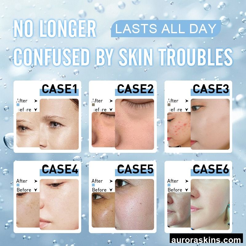 14 in 1 Oxygen Jet Diamond Peeling Deep Cleaning Facial Machine Water Facial Micro Dermabrasion Hydrodermabrasion Facial Machine