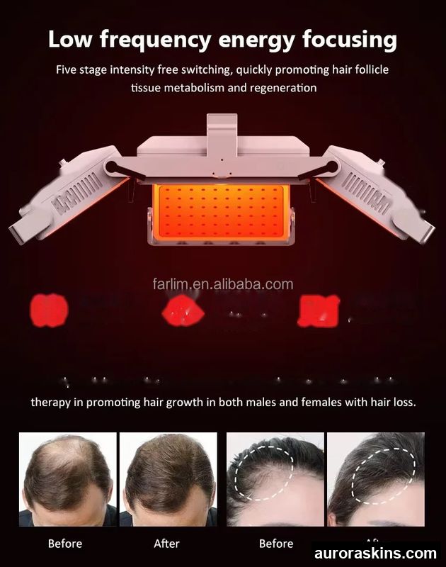 2026Hair Loss Treatment Instrument Scalp Massage Instrument Scalp Detection Hair Care Scalp Mites Removal Beauty Salon Equipment