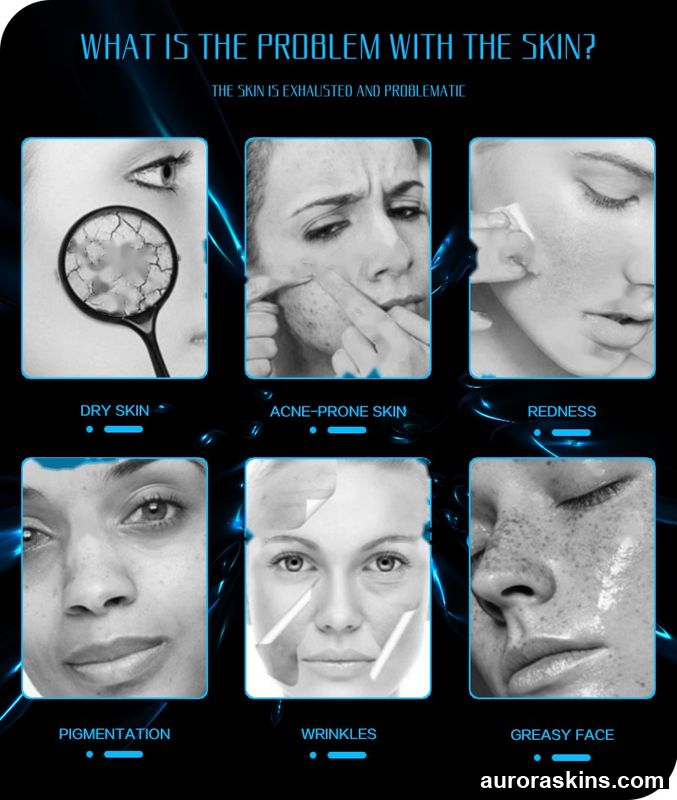 Facial Instrument Deep Cleaning Hydraulic Exfoliation Oxygen Machine Multifunctional Skin Care Beauty Spa Microcrystalline 2026