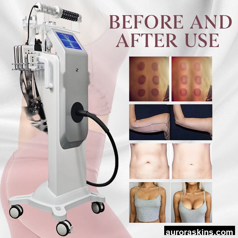 2026 80K G5 Vibration Massage Full-body Fat-burning Fat Reduction Breast Massager 10-in-1 Multifunctional Body Slimming Machine