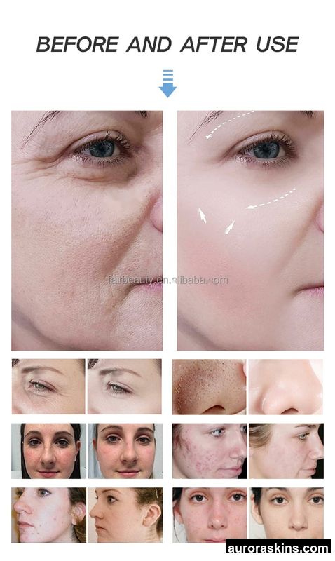 Oxygen Facial Machine 8 1 Super Bubble Skin Rejuvenation Co2 Oxygen Bubble Oxygen Face Cleaning Co2 Bubble Facial Machine