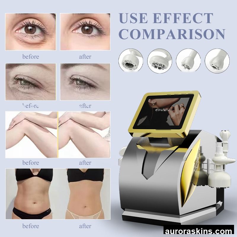 Negative Pressure Inner Roller Body Slimming Inner Roller Lymphatic Drainage 360 Degree Rotating 360 Rotating Rolling Machine
