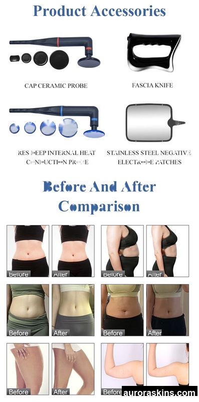 2026 Popular in Spain-Indiba 448K CET RET Deep Heat Beauty Device for Skin Firming and Weight Management.