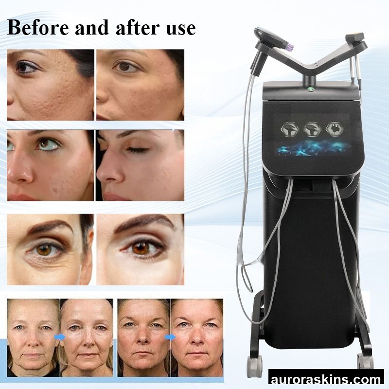 4in1 Crystallite Depth M8 Fractional Radiofreuency Skin Tighten Firming 2026 Vertical M8 Fractional Machine Face Body Machine