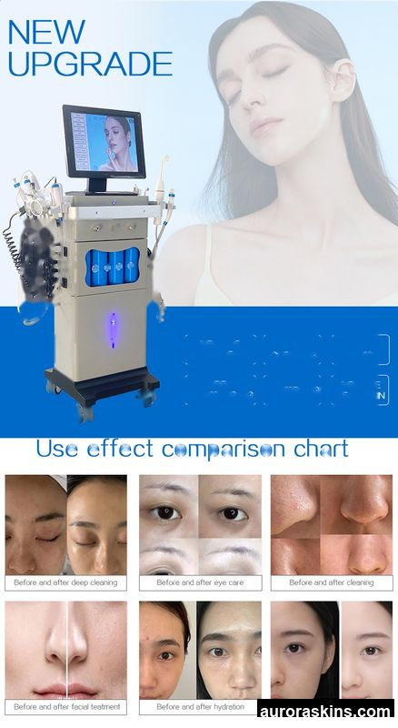 2026 Aurora Skins New 14-in-1 Microdermabrasion System-Face Brightening, Lifting & Deep Cleansing-Beauty Device