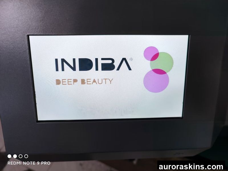 Desk Indiba 448k CET RET Tecar Physical Therapy 448Khz Pain Relief Physiotherapy CET RET Machine
