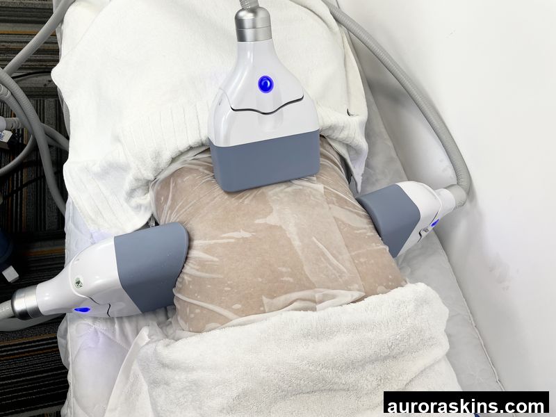 Professional Cryo Machine Body Contouring Improve Blood Circulation Remove Double Chin 4D Vacuum Suction Device