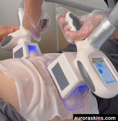 Aurora Skins a 2in1 Cryotherapy Homeuse Loseweight Beauty Body Shaper Vacuum Cupping Ice Cool Slimming Firming Sculpting Spa Skincare