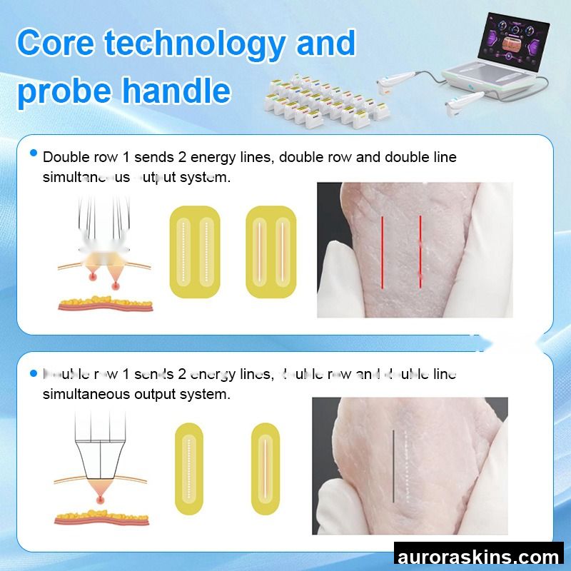 2026 New Double Handle Skin Tightening Instrument SMAS H1fu Facial Lifting Wrinkle Removal Hefu SMAS Beauty Instrument for Salon