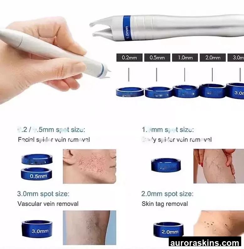 4 in 1 Red Vein Spots Removal 980nm Laser Vascular Removal Machine Diode Infrared Laser Spider Vein Removal Machine