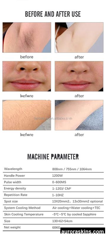 2026 Trendy 3-Wavelength Ice Photon Salon Device-755/808/1064nm, Platinum, Quick & Painless, Lasting Hair Reduction
