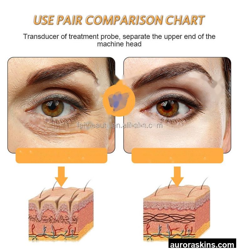 2026 2-in-1 Portable M8 Facial Rejuvenation Micro Wrinkle Removal Stretch Marks Removal Anti-Wrinkle Microcomputer