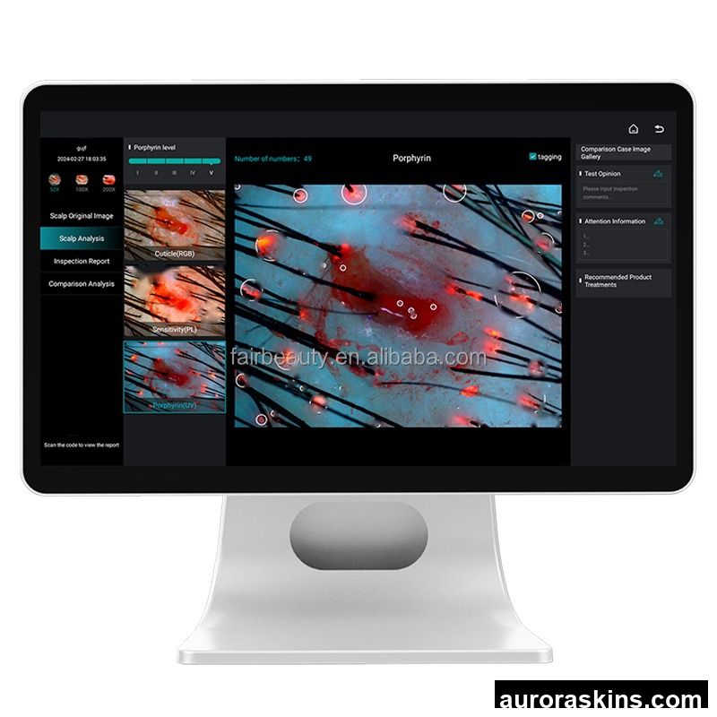 2025 Ai Digital Skin Detector Moisture Tester 15.6 Inch HD Screen Portable Hair Analyzer Machine New Technology Skin Analysis