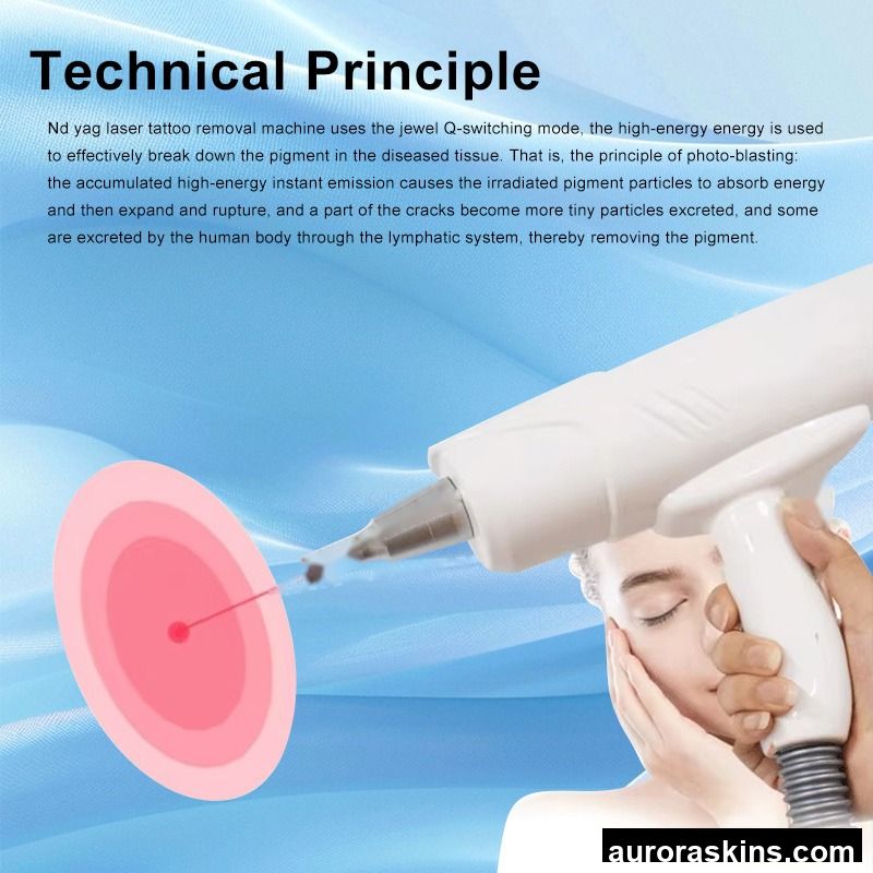 Aurora Skins a Portable Facial Spa Homeuse Machine for Face 755 1064 1320nm hollywood Peel Skincare Facial Personal Care Machine