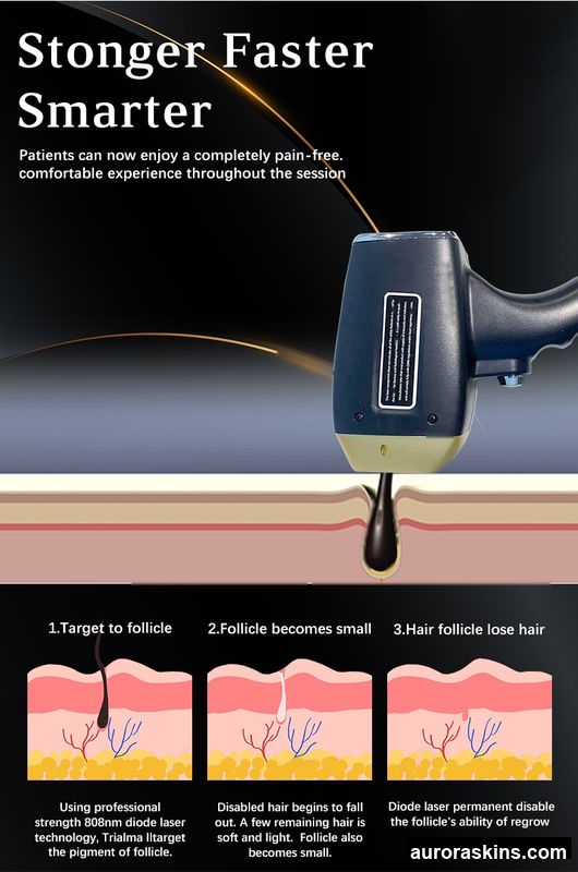 2025 Newest Ice Titanium Laser Hair Removal Diode Laser Hair Removal Machine Professional Permanent Hair Removal Price