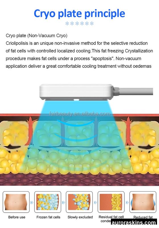 2026 Non-invasive 4 Freezing Pads Fat Reduction and Body Firming 100Hz Skin Tighten Breast Massager Body Shaping Beauty Device