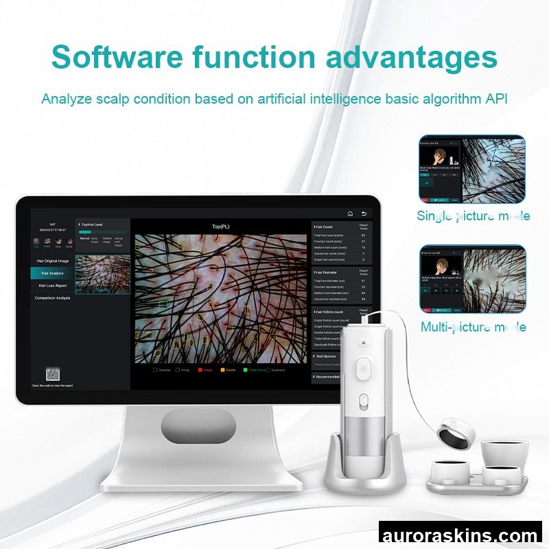 High Quality15.6 HD Hair Follicles Scalp Scanner Detector Hair Analyzer Scalp Care Machine Skin and Scalp Hair Analysis Machine
