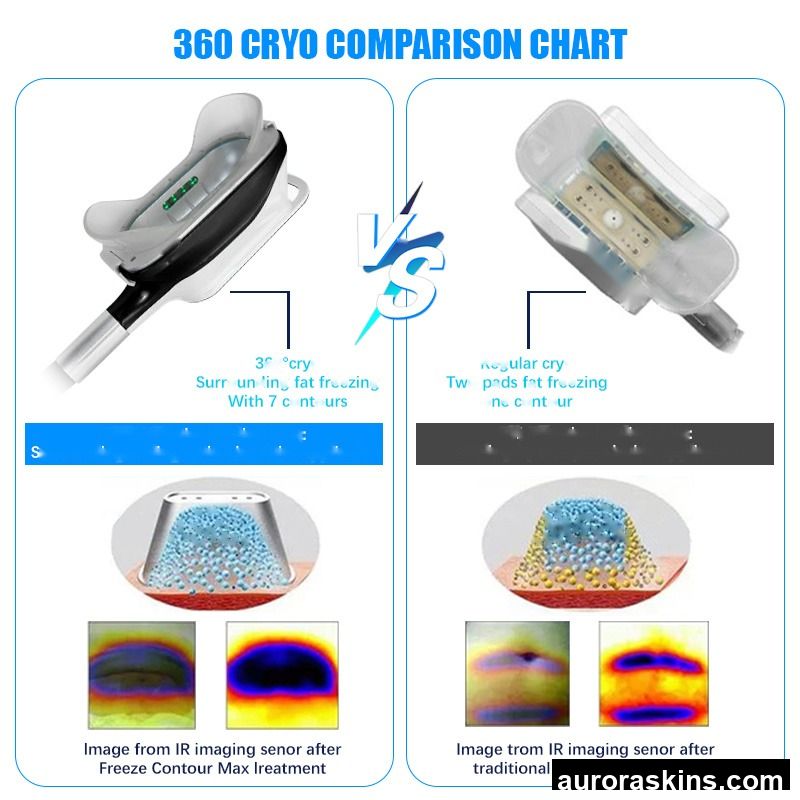 2026 Non-invasive -10°C to 5°C Weight Loss Skin Tightening Cryo Handles Fat Loss Breast Massager Body Contouring Slim Machine